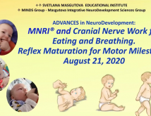 Advances in Neurodevelopment MNRI and Cranial Nerve Work for Eating and Breathing Child Motor Development and Milestones 02 months